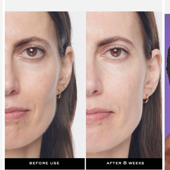 Lancome Renergie H.C.F A NEW TRIPLE-ACTION SERUM - Picture 3 of 7